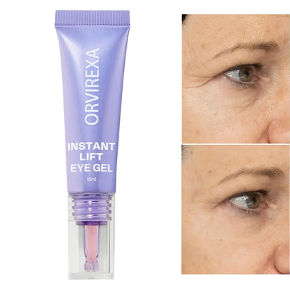 ORVIREXA Instant Lift Eye Gel – Fast Acting for Puffiness & Under Eye Bags, Smooth Fine Lines, 0.34 oz
