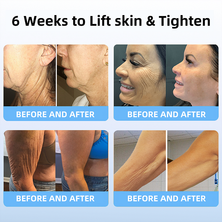 ORVIEXA®Skin Lifting Wrinkle Removal Cream