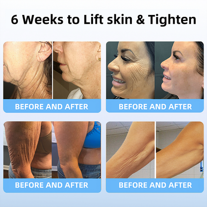 ORVIEXA®Skin Lifting Wrinkle Removal Cream