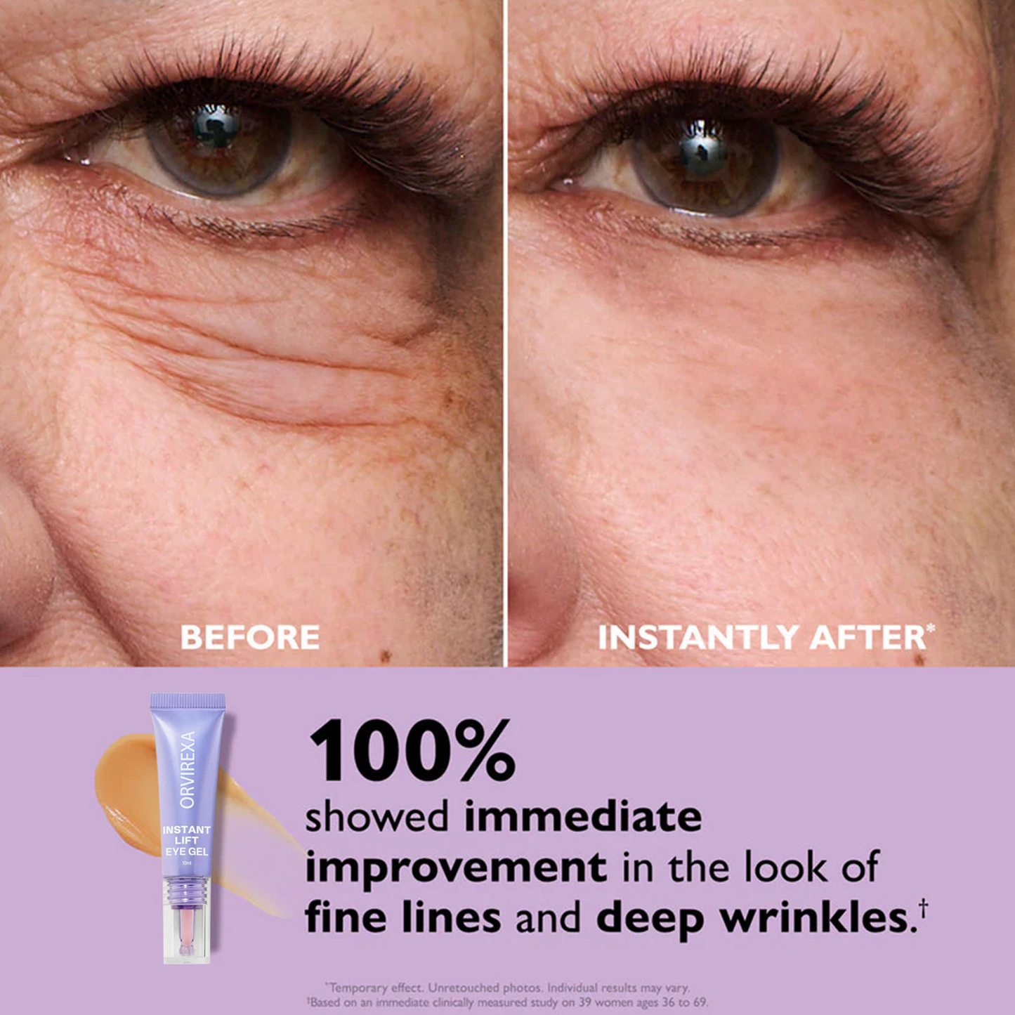 ORVIREXA Instant Lift Eye Gel – Fast Acting for Puffiness & Under Eye Bags, Smooth Fine Lines, 0.34 oz