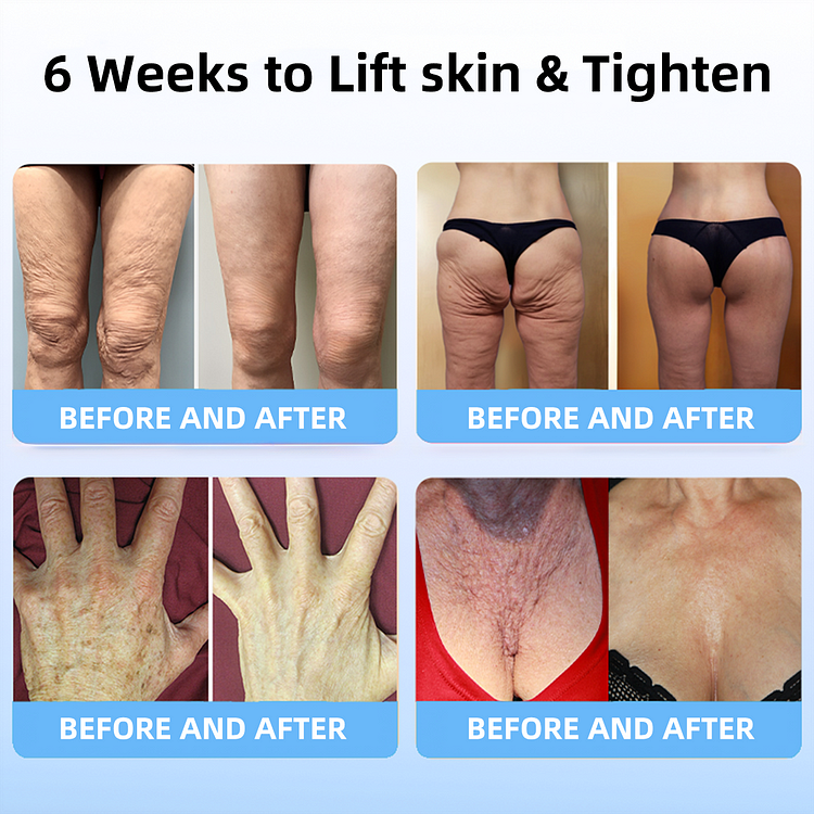 ORVIEXA®Skin Lifting Wrinkle Removal Cream