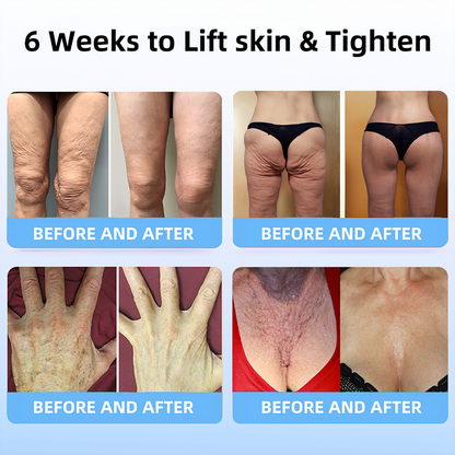 ORVIEXA®Skin Lifting Wrinkle Removal Cream