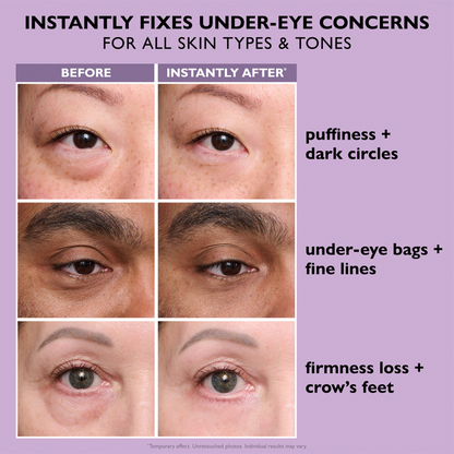 ORVIREXA Instant Lift Eye Gel – Fast Acting for Puffiness & Under Eye Bags, Smooth Fine Lines, 0.34 oz
